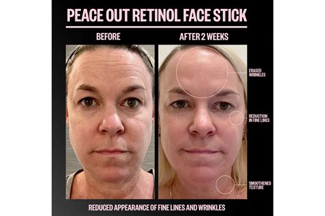 Faultless Magic Wrinkle Relaer: The Latest Advancement in Skincare Technology